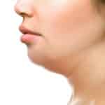 Double Chin Fat