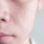 Large Pores