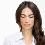 Melasma
