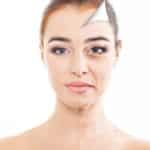 Aging Skin