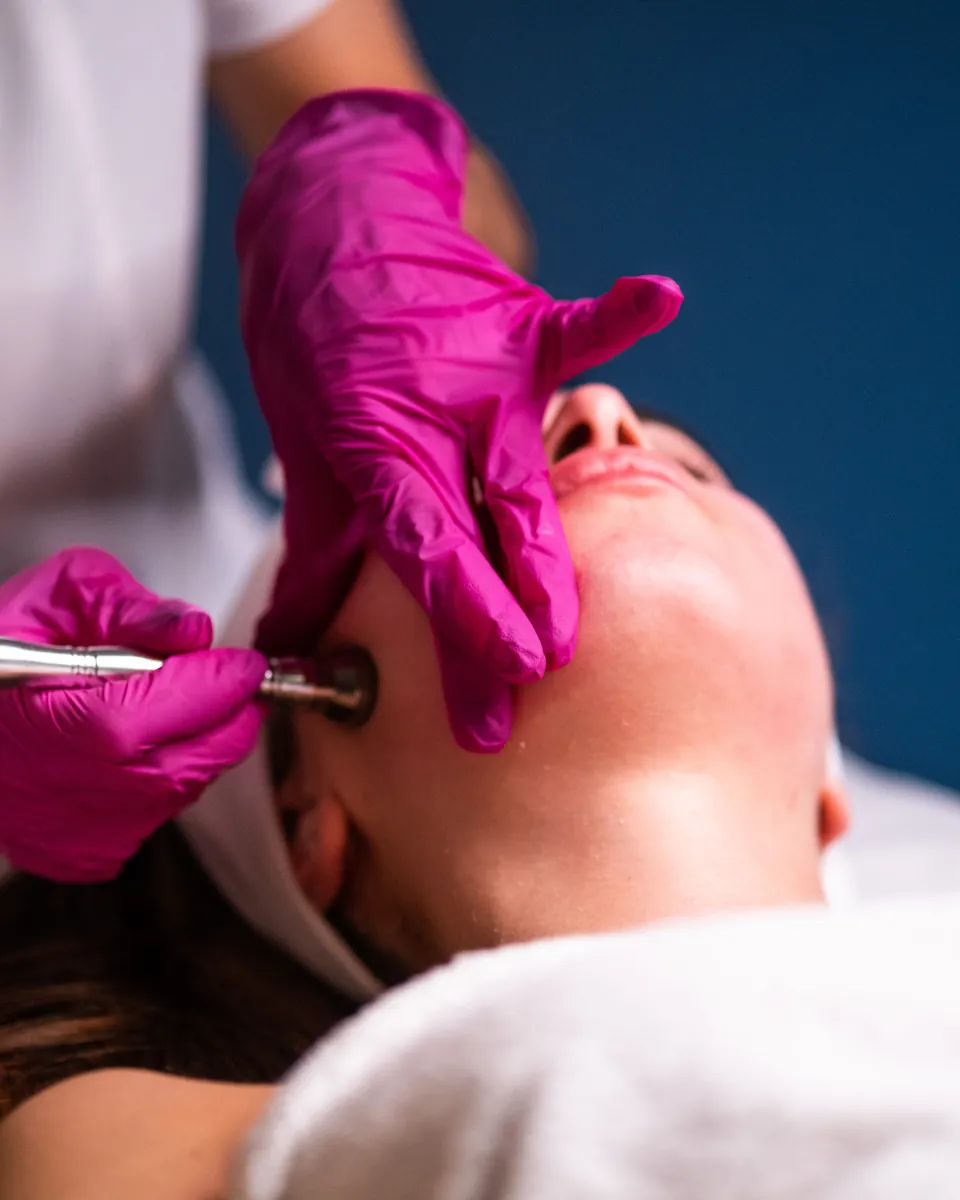 Diamond microdermabrasion treatment on a client's cheek at 4D